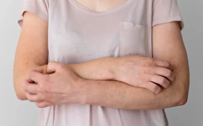 Ekcéma röviden: felismerés, okok, kezelés